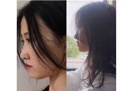 乔雅登玻尿酸怎么分别大中小分子的? 乔雅登玻尿酸怎么分别大中小分子的?