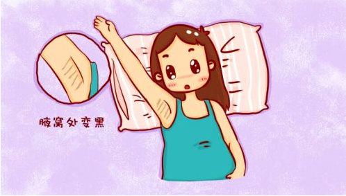 产后腋下黑怎么办 分享产后腋下黑怎么去除