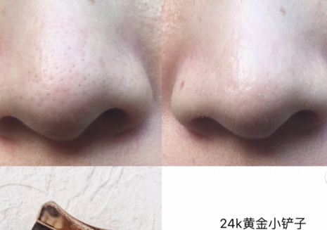 The Beautools毛孔清洁器假货？真的有用吗？